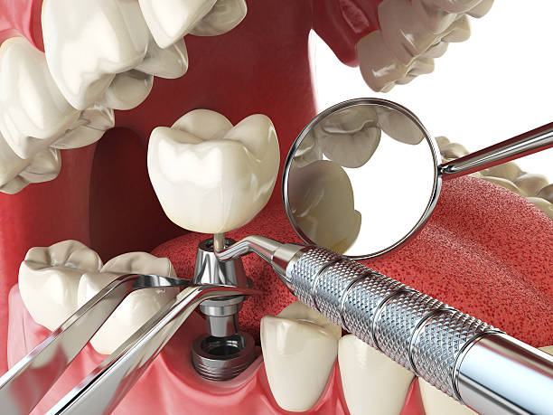 Best Walk-In Emergency Dental Services in Delavan, WI